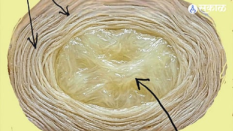 Spine Anatomy: Understanding the Structural Role of Discs as Shock Absorbers