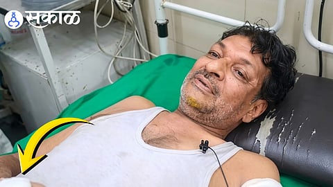 Shivaji Shinde attack news in Parli