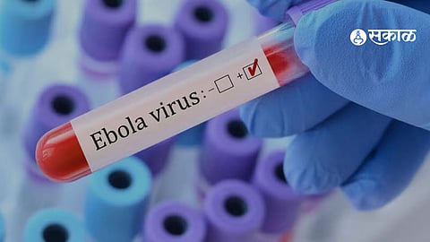 Ebola Scare in India? Ahmedabad on Alert After Congo Traveler Isolated