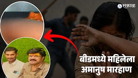 Beed Woman Brutally Assaulted