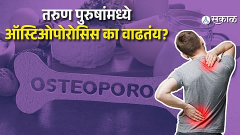Osteoporosis in Young Men