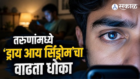 Digital Addiction Alert: Rising Risk of Dry Eye Syndrome Among Young Adults