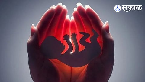Female Foeticide Case