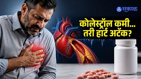 Cholesterol & Heart Attack