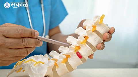 Dr. Ajay Kothari’s guide on understanding slip disc, its symptoms, and effective treatment methods