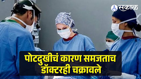  Mass of hair removed from girl stomach