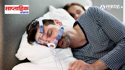 Obstructive Sleep Apnea