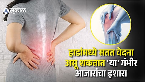 Persistent Bone Pain Causes