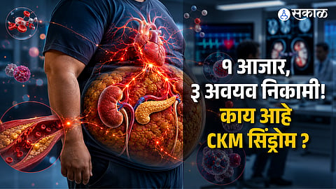 cardiovascular-kidney-metabolic (CKM) syndrome