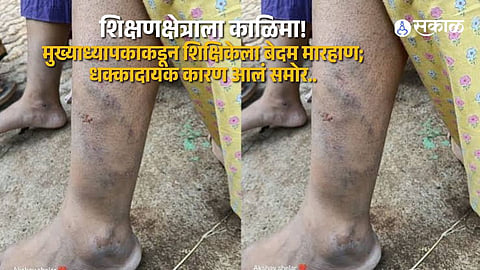 Satara Shocker: Female Teacher Assaulted by Headmaster in Zilla Parishad School