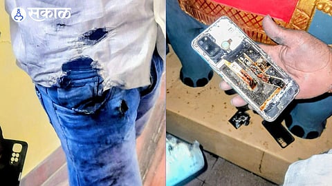 Chinese Smartphone Explodes Inside Pocket