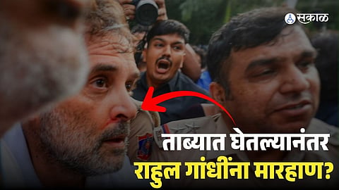 Rahul Gandhi Nose Bleeding Photo Goes Viral After Detention