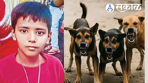 Solapur child dies due to rabies