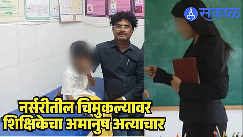 Teacher burns Student private part