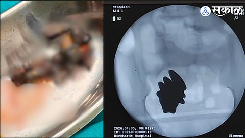 medical experts have urged parents to keep magnets, button batteries, and other small metal objects away from children and seek immediate medical care if ingestion is suspected.