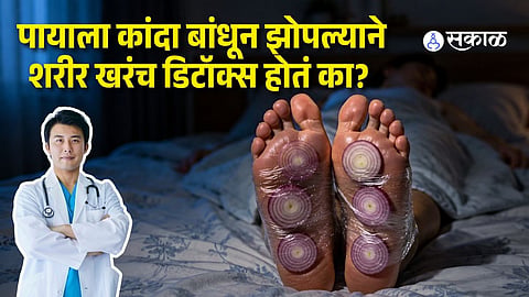 Viral Onion-on-Feet Detox Trend Explained