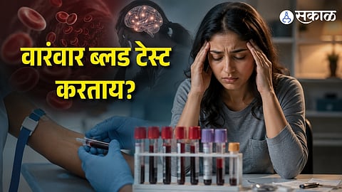 Health Checkup Warning: Why Excessive Blood Testing Can Lead To Anxiety And Anemia