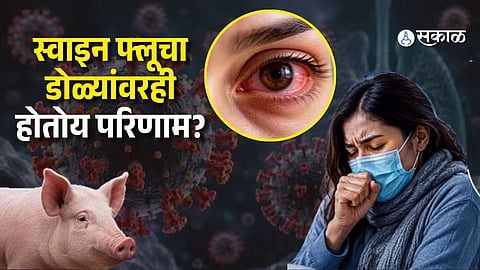 Swine Flu and Your Eyes: 7 Warning Signs That May Need Medical Attention