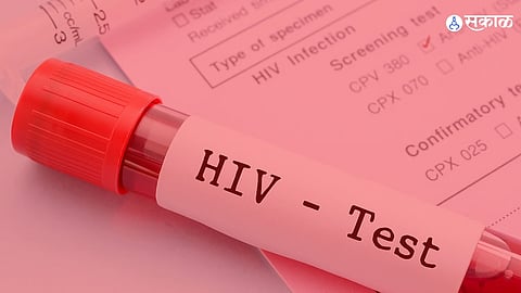  Assam Jails HIV Cases 