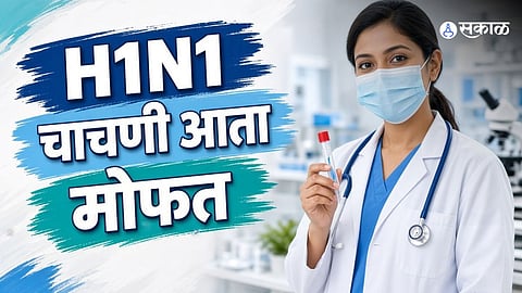 Swine Flu Outbreak In Uttar Pradesh Yogi Government Orders Free Tests And Strengthens Preparedness In Government Hospitals