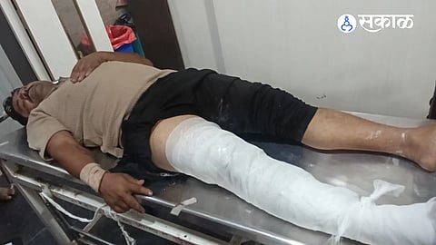Tempo driver assaulted over suspected onion theft.