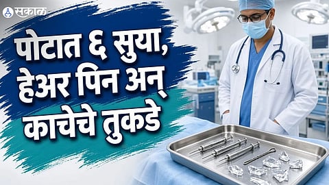 prayagraj woman Pica Disorder