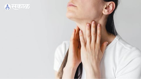 Swollen Lymph Nodes