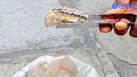 Ration Rice Shock Seven Tooth Denture Found in Food Grain Sparks Concern Among Beneficiaries Over Government Rice Quality