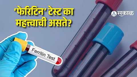 Ferritin Test