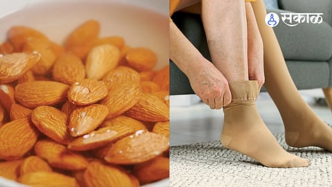 Family Doctor Guidance: Ayurvedic Remedies for Fatigue After Marriage and Varicose Veins