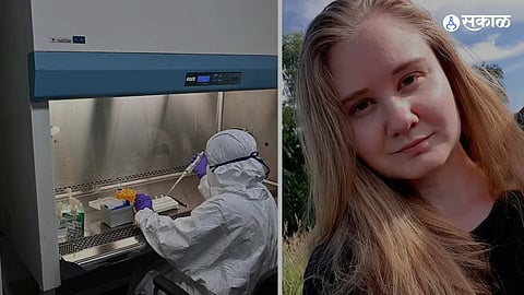 Russia Lab Technician Death 
