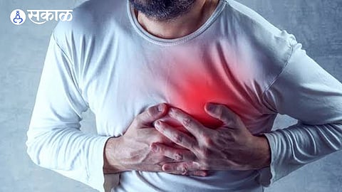 heart attack