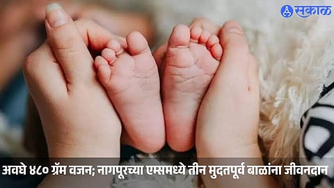 AIIMS Nagpur’s medical team successfully treats three premature babies weighing just 480, 600 and 630 grams, who return home after three months of intensive care.