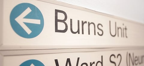 Burnt ward modernization project is not yet