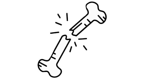 Bone