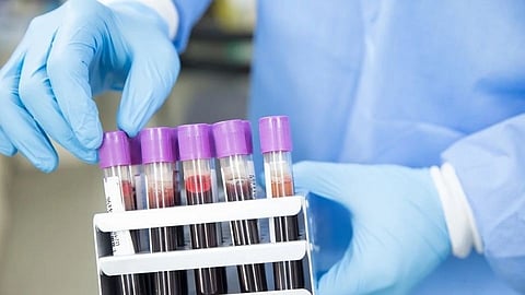 Mulwad patients have to travel eighty kilometers for RTPCR test Nasik Marathi News