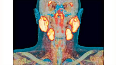Salivary-glands