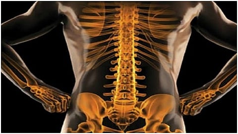 Osteopenia is pre-osteoporosis reduced bone fragility bone pain and early fatigue