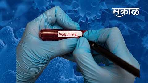 धुळे जिल्हाधिकारी संजय यादव यांना कोरोनाची बाधा 