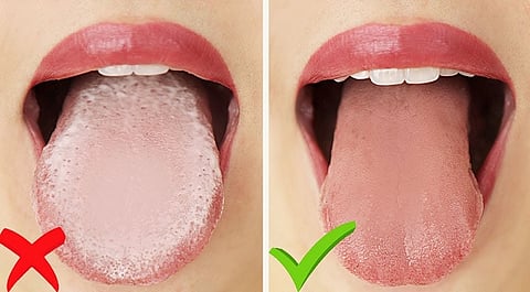 Don't ignore the tongue