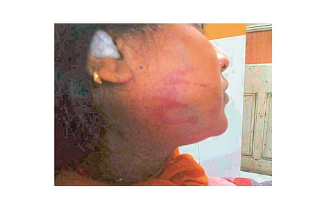 woman slaped