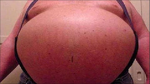 60 year old man got pregnant shocked after pakistans lab reoprt