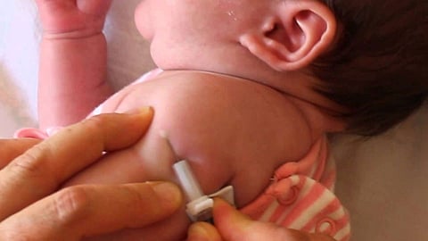 BCG Vaccine