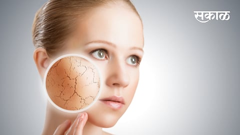अनेक महिलांच्या चेहऱ्यावर आणि त्वचेवर रिॲक्शन होऊ शकते. यामुळे त्वचेवर डाग येण्याचीही चिन्हे असतात. मात्र आता चिंता करू नका. कुठलीही रिॲक्शन झाल्यास आम्ही पुढे सांगितलेल्या बाबींकडे नक्की लक्ष द्या. 