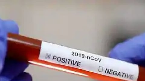 corona positive