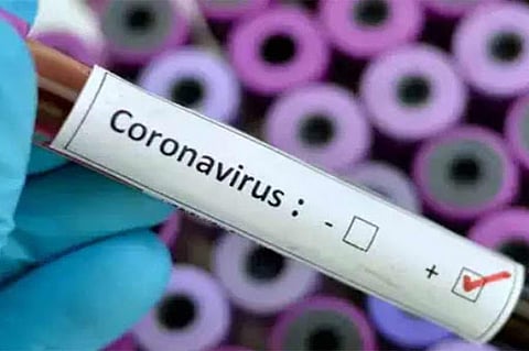  Corona trapped in the city ... The number of positive patients is five hundred