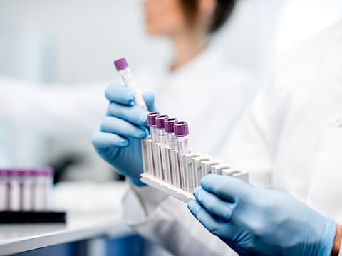 corona lab