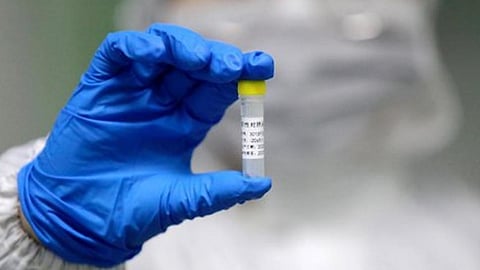 coronavirus