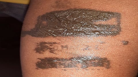 Fear of ink following Corona