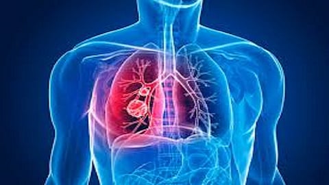 want to keep Pleural strong then do these remedies 
